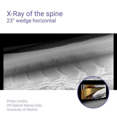 Podoblock Aluminium Wedge