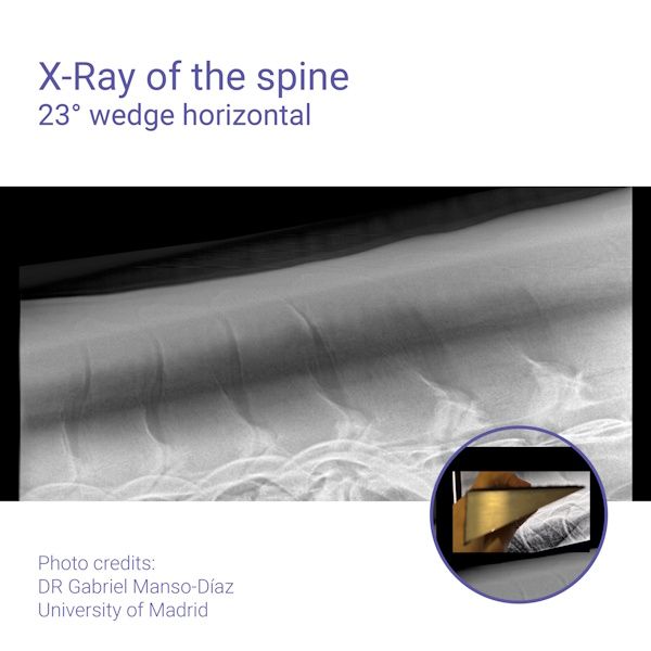 Podoblock Aluminium Wedge