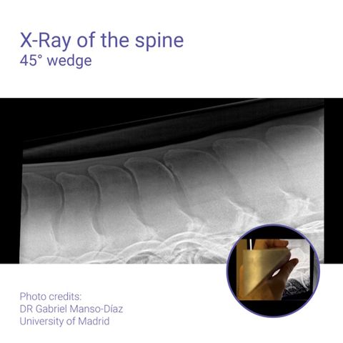 Podoblock Aluminium Wedge