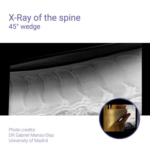 Podoblock Aluminium Wedge