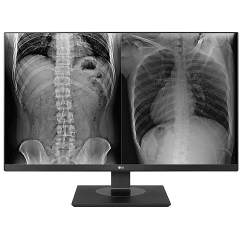 LG 27" 8MP Clinical Review Monitor