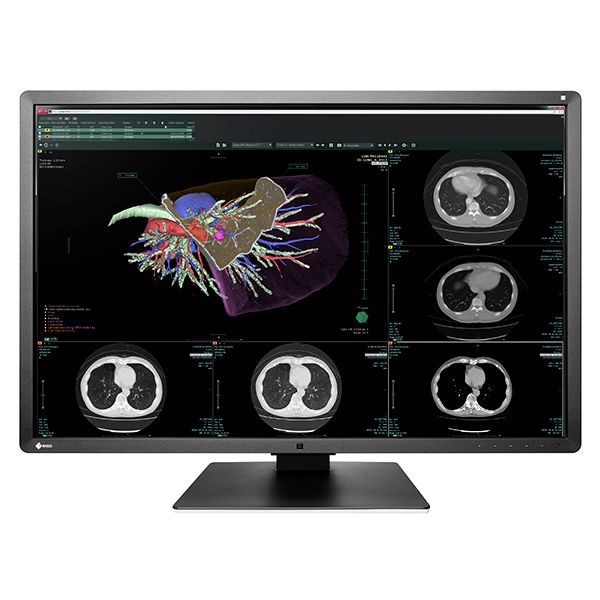 Eizo RadiForce RX660 31" 6MP LED Medical Colour Monitor