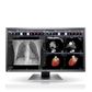 Eizo RadiForce MX315W 31" 8MP LED Clinical Review (XL)