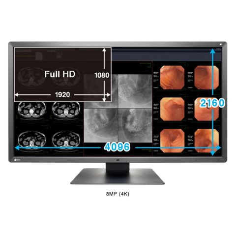 Eizo RadiForce MX315W 31" 8MP LED Clinical Review (XL)