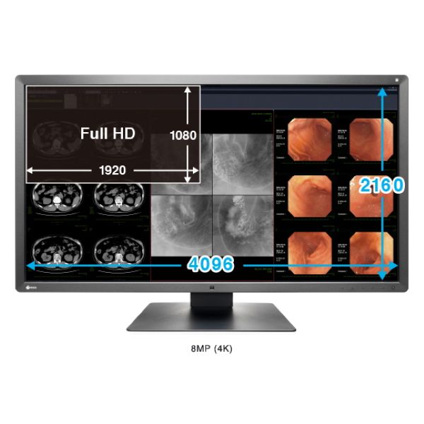 Eizo RadiForce MX315W 31" 8MP LED Clinical Review (XL)