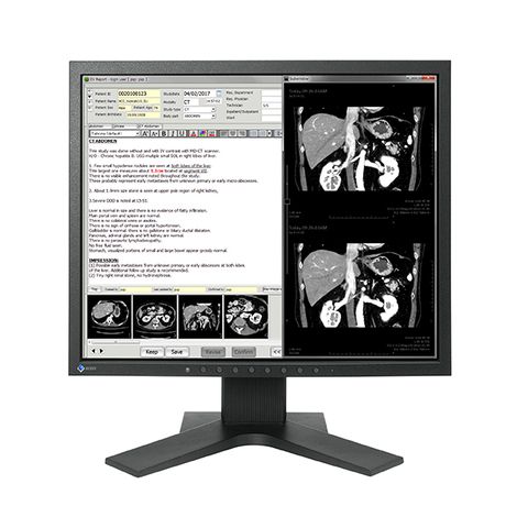 Eizo Radiforce MX194 19.0" 1MP Colour LCD Monitor