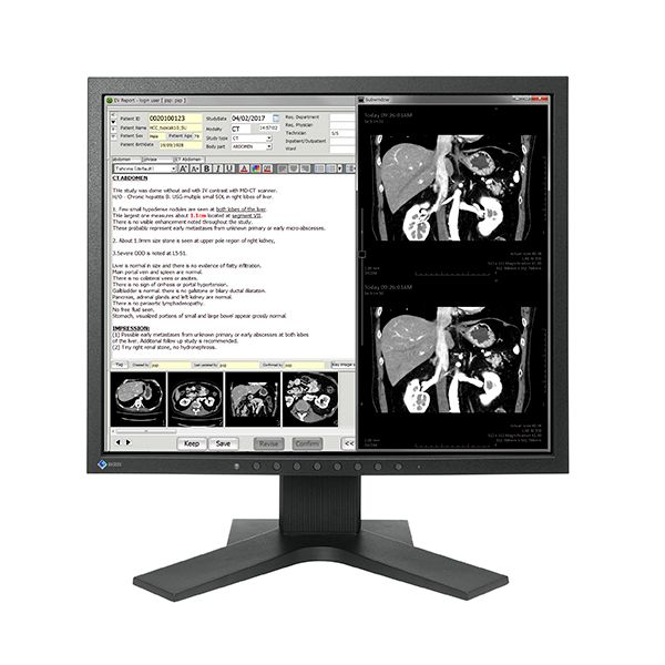 Eizo Radiforce MX194 19.0" 1MP Colour LCD Monitor