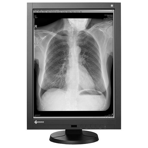 Eizo Radiforce GX340 21.3" 3MP Monochrome LCD Monitor