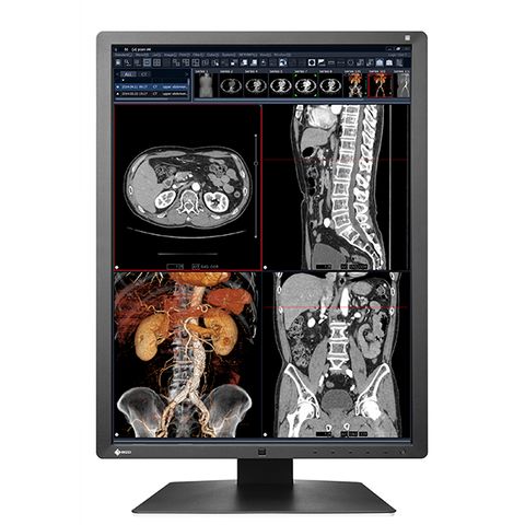 Eizo Radiforce RX250 21.3" 2MP Color LCD Monitor