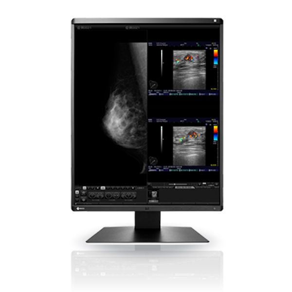 Eizo Radiforce RX560 21.3" 5MP Colour LCD Monitor