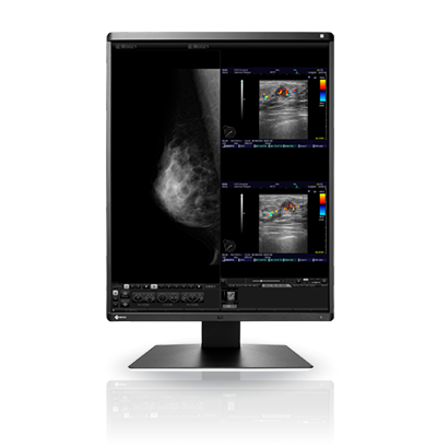 Eizo Radiforce RX560 21.3" 5MP Colour LCD Monitor