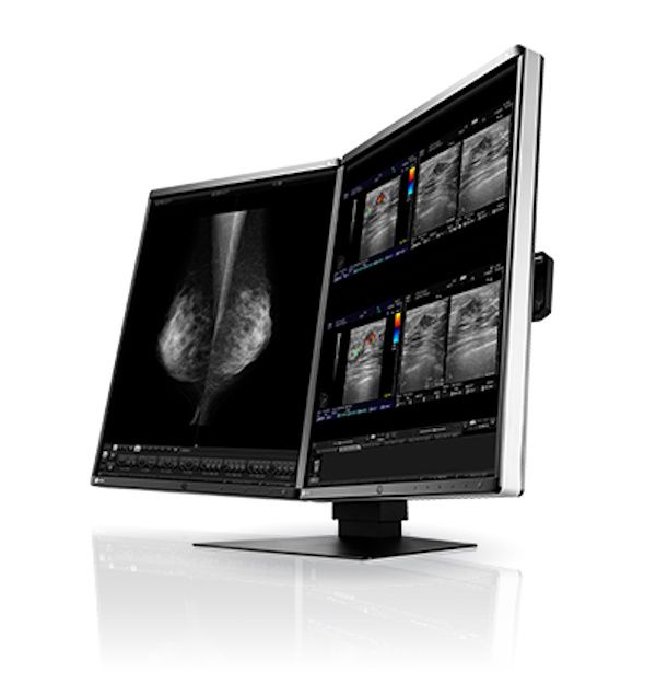 Eizo Radiforce RX560 21.3" 5MP Colour LCD Monitor