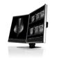 Eizo Radiforce RX560 21.3" 5MP Colour LCD Monitor