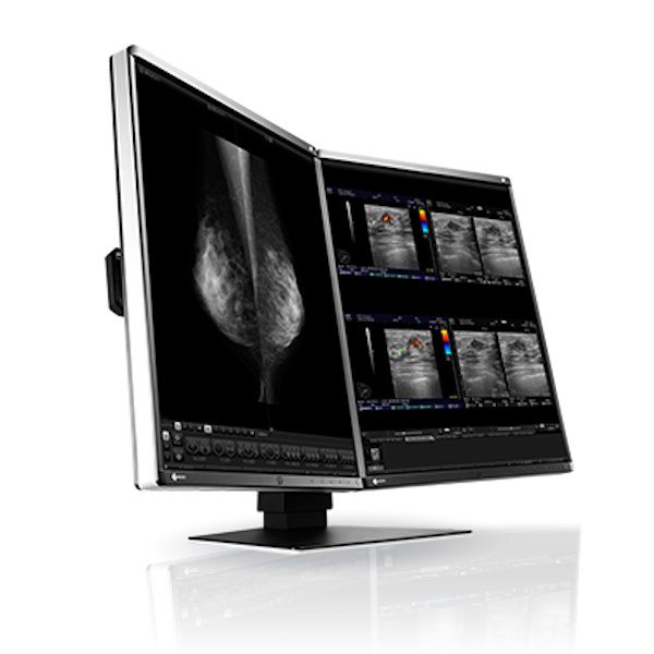 Eizo Radiforce RX560 21.3" 5MP Colour LCD Monitor