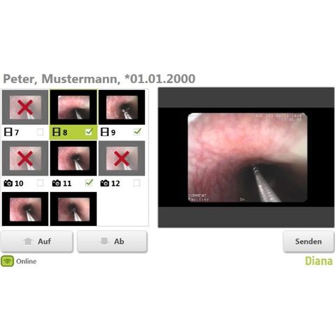 DEKOM DIANAdicom HD Video Capture to DICOM System