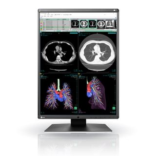Eizo Radiforce RX360 21" 3MP LED Medical Colour Monitor