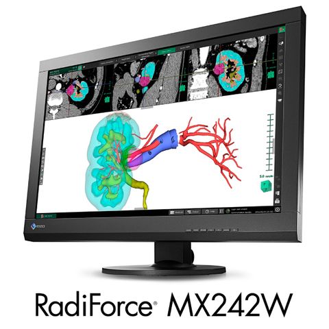 Eizo RadiForce MX242W 24.1" 2MP Clinical Review Monitor, Black