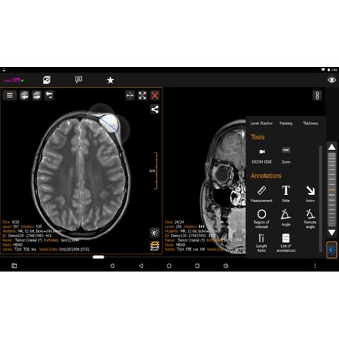 PORT-RAY Image Viewer for MED-TAB