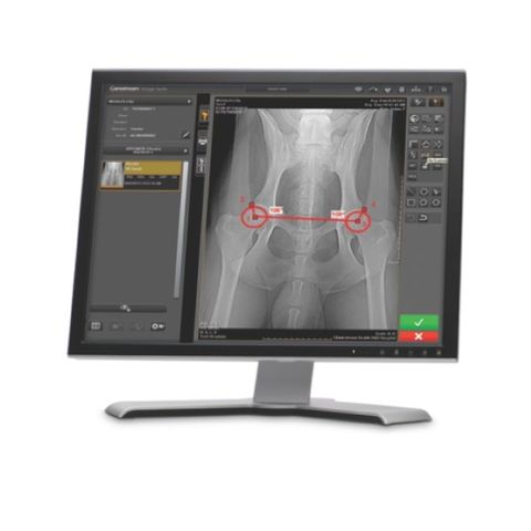 Carestream Image Suite Advanced Tool Set Software License