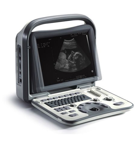 NeuSonic PC Portable Diagnostic Imaging System with THI & 4B Mode with 1 Convex Probe (2-6 MHz)