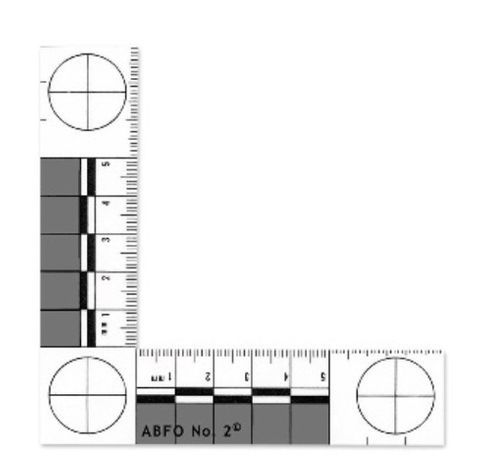 ABFO No 2 Bitemark Scale