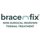 Bracenfix