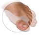 Bunion Protection