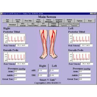Hadeco Doppler Software