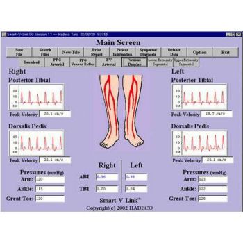 HADECO SMART-V-LINK DOPPLER SOFTWARE WITH USB CABLE FOR 100V3, BIDOP 7, SD45 & SD30