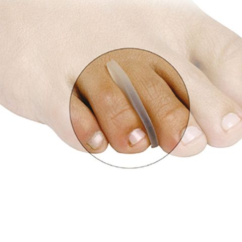 M2-Gel Toe Separators