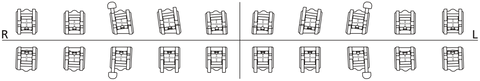 1 Case discovery Sl 2.0 MBT