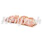 ZH Bacon Rashers Rindless Cafe 5kg