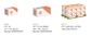 Cone Lock HCL Nut - HT ZP M22 (Box=25)