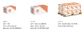 Cone Lock HCL Nut - HT ZP M12-1.50 FINE (Box=100)