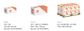 Cone Lock HCL Nut - HT ZP 1/4UNC x (Box=100)