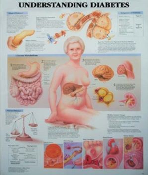 CHART UNDERSTANDING DIABETES