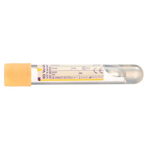 SST TUBES