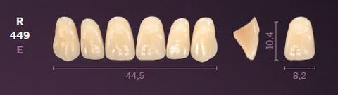 R449-D4 MONDIAL TEETH UPPER ANTERIOR