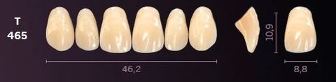 T465-A35 MONDIAL TEETH UPPER ANTERIOR