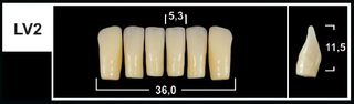 LV2 A1 LOWER ANTERIOR TRIBOS TEETH