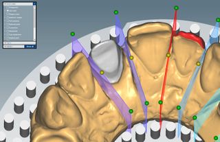 CERAMILL M BUILD MODEL SOFTWARE