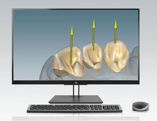 CERAMILL MICROSHELL