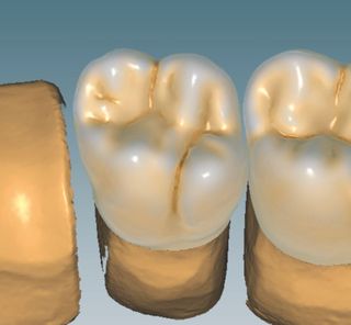 CERAMILL MIND SOFTWARE