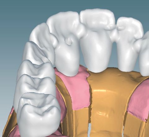 CERAMILL M PLANT