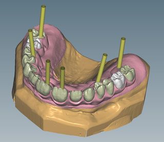 CERAMILL M-GIN MIND UPGRADE