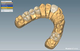 CERAMILL MINDFORMS CUTBACK EXTENSION