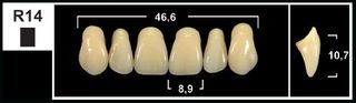 R14 B3 UPPER ANTERIOR TRIBOS TEETH