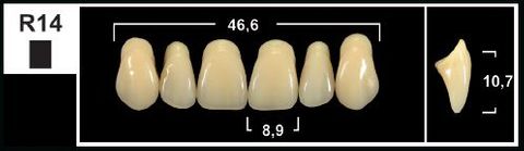 R14 B1 UPPER ANTERIOR TRIBOS TEETH