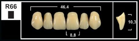 R66 A2 UPPER ANTERIOR TRIBOS TEETH