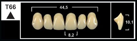 T66 D2 UPPER ANTERIOR TRIBOS TEETH